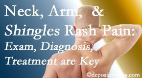 Executive Chiropractic of Iowa starts with a diagnosis, develops a treatment, and gets pain-relief results even in unusual conditions like neck pain, arm pain and a shingles rash!