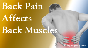 Executive Chiropractic of Iowa treats not only back pain related to degenerative spine conditions but also the related degenerative back muscles.