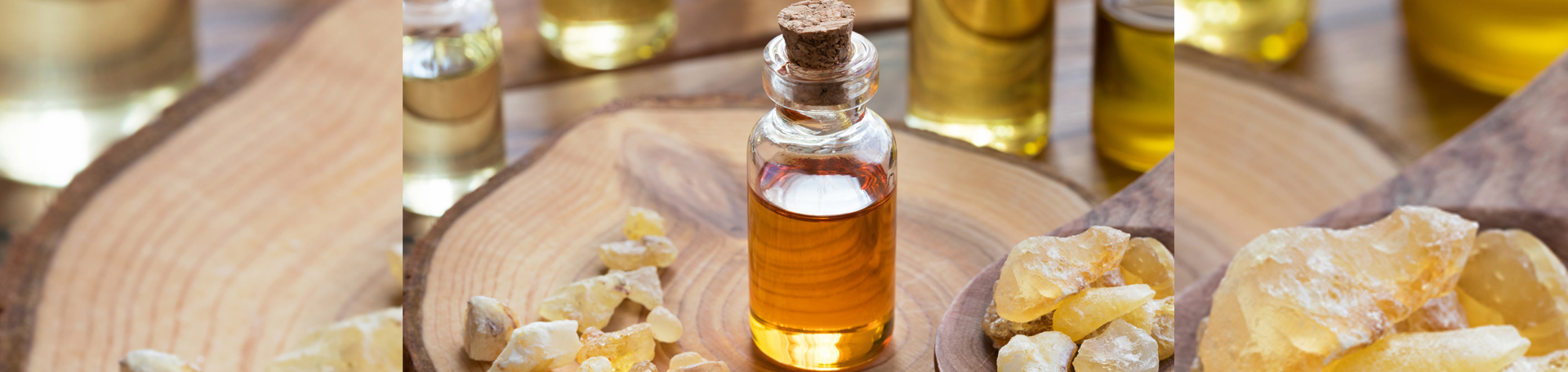 West Des Moines anti-inflammatory frankincense