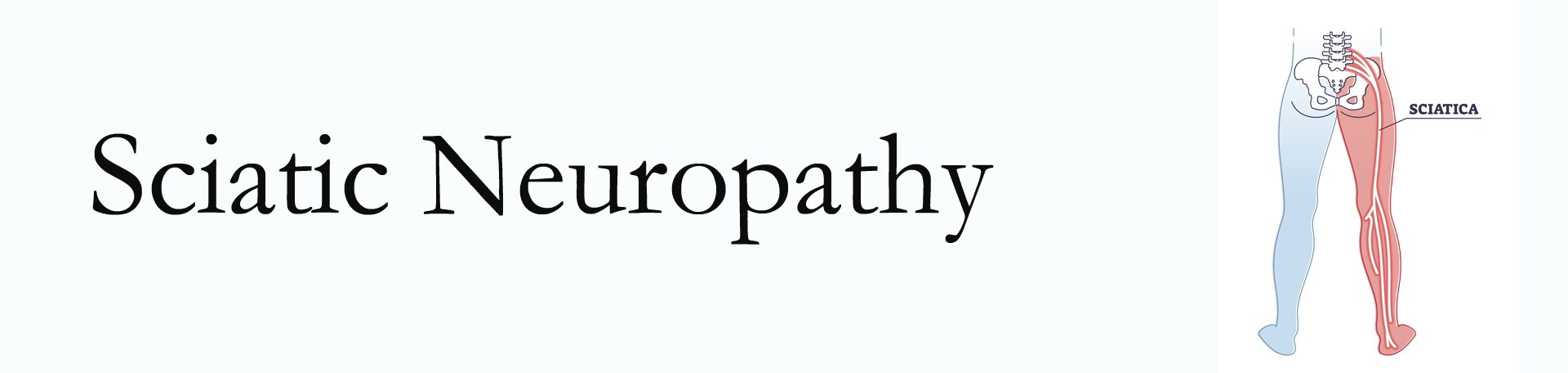 West Des Moines neuropathy pain (sciatica) 
