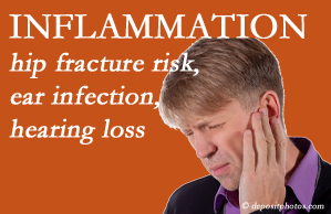 Executive Chiropractic of Iowa recognizes inflammation’s role in pain and shares how it may be a link between otitis media ear infection and increased hip fracture risk. Interesting research!