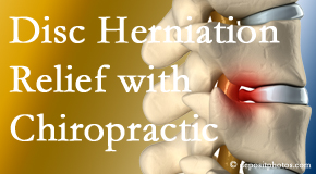 Executive Chiropractic of Iowa gently treats the disc herniation causing back pain.